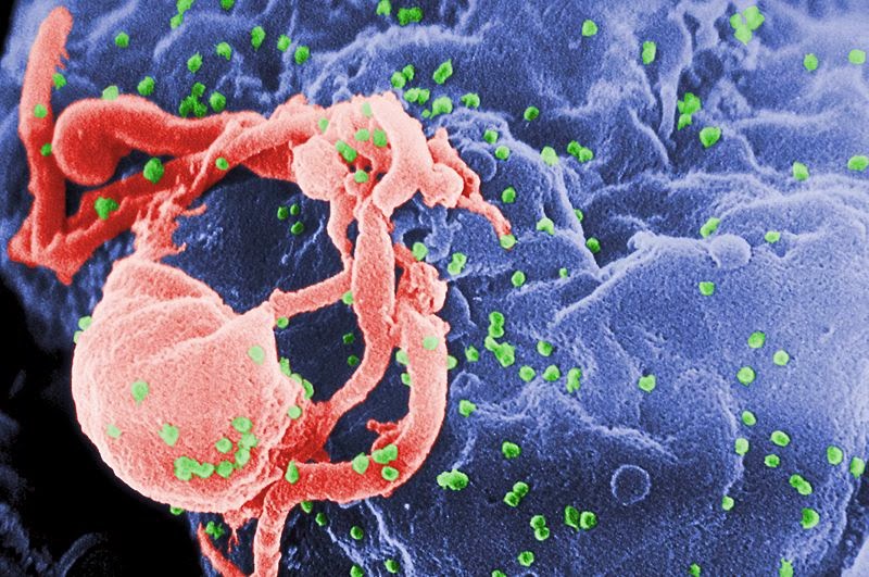 Scanning electron micrograph of HIV-1 budding (in green) from cultured lymphocyte Image: C. Goldsmith (AIDS)