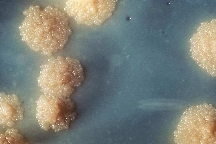 close-up of a Mycobacterium tuberculosis culture revealing this organism’s colonial morphology