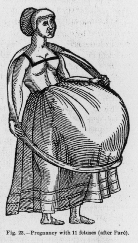 "Pregnancy with 11 fetuses" Giovanni Pico della Mirandola reported the case of an Italian woman, Dorothea, who allegedly gave birth to undecaplets after having given birth to nonuplets, from Ambroise Paré 'Anomalies and Curiosities of Medicine'