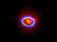 SN 1987A – The Best Studied Supernova of All Time