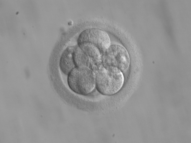 8-cell human embryo