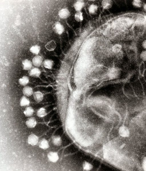 An electron micrograph of bacteriophages attached to a bacterial cell. These viruses are the size and shape of coliphage T1