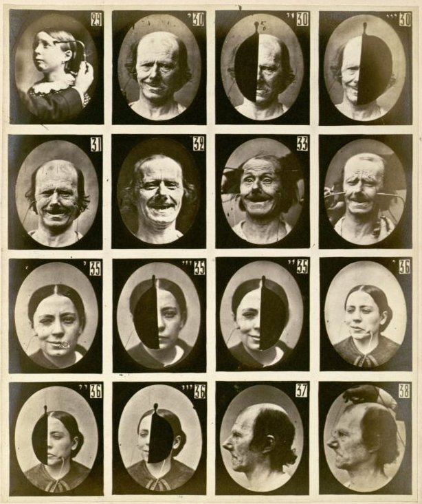 Duchenne de Boulogne, Facial expressions triggered by electric stimulation