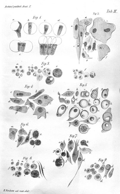 Illustration of Virchow's cell theory, Archiv für Pathologische Anatomie und Physiologie (now known as “Virchow’s Archives”), 1847, first issue